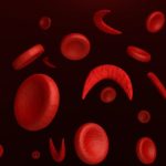 Doena-Falciforme
