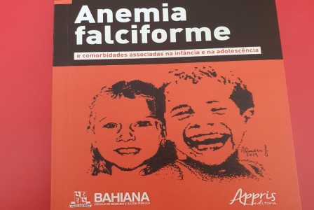 Anemia_Falciforme