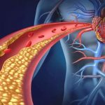 coracao-colesterol-arterias_Foto_Lightspring_Shutterstock