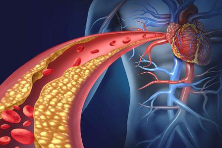 coracao-colesterol-arterias_Foto_Lightspring_Shutterstock