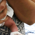 Dia_da_Doena_Falciforme